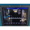 Laptop Color Doppler Ultrasound Machine